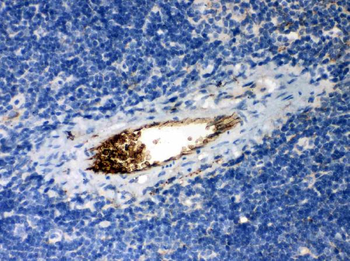 Anti-alpha 1 Antitrypsin/SERPINA1 Antibody