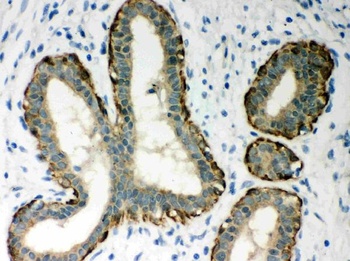 MASPIN/SERPINB5 Antibody