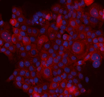 Anti-MASPIN/SERPINB5 Antibody