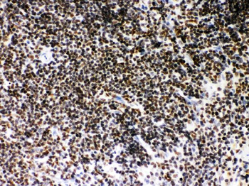 Anti-SIRT7 Antibody