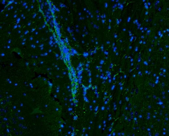 Anti-Vimentin Antibody