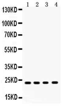 Anti-RBP4 Antibody