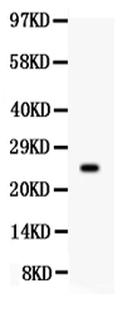 Anti-Prolactin/PRL Antibody