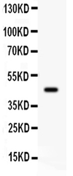 beta 2 Adrenergic Receptor/ADRB2 Antibody