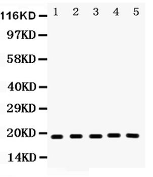 Anti-Caspase-2/CASP2 Antibody
