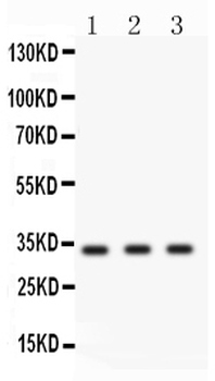 Anti-Cyclin D1/CCND1 Antibody