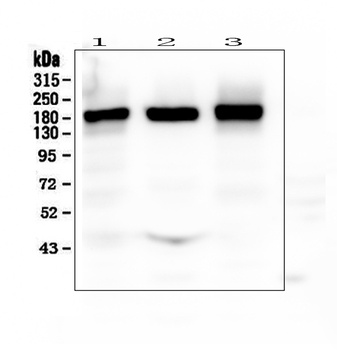 NMDAR2B/GRIN2B Antibody
