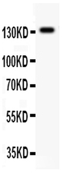 Anti-NMDAR2C/GRIN2C Antibody