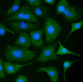 Anti-PKM2 Antibody