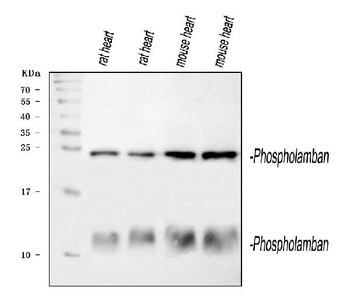 Phospholamban/PLN Antibody