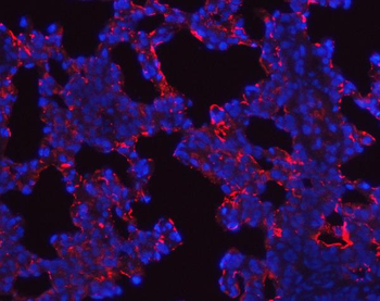 Anti-SFTPA1/2 Antibody