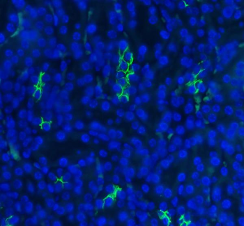 Anti-SLC12A1 Antibody