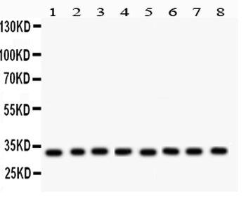 Anti-SMN1/2 Antibody