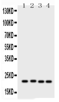 Anti-SOCS2 Antibody