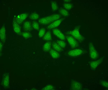 Anti-Superoxide Dismutase 1/SOD1 Antibody