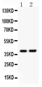 Anti-SOX1 Antibody