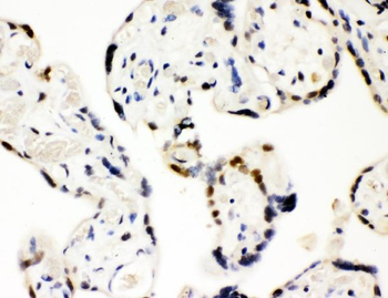 Anti-SF2/SRSF1 Antibody