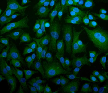 Anti-STIM1 Antibody