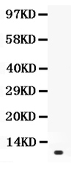 Anti-Prolactin/PRL Antibody