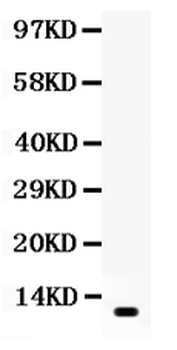 Anti-Resistin/RETN Antibody