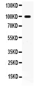Anti-RANK/TNFRSF11A Antibody