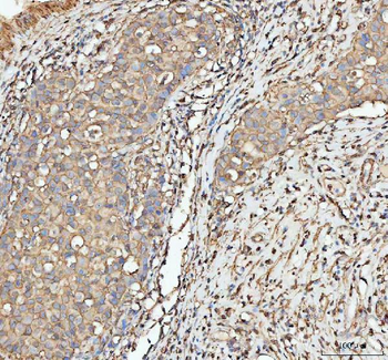 Anti-Actin/ACTA1 Antibody