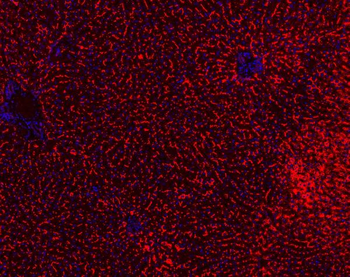 Anti-ABCB11 Antibody