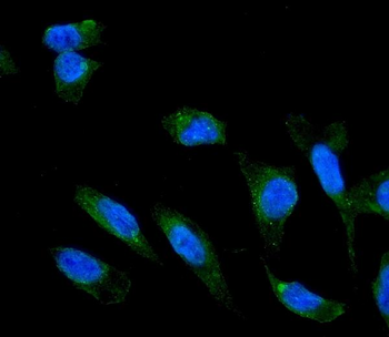 Anti-Adiponectin Receptor 1/ADIPOR1 Antibody