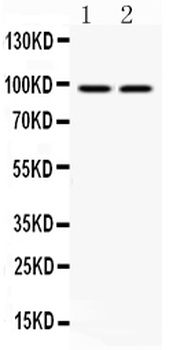 Anti-Aryl hydrocarbon Receptor/AHR Antibody