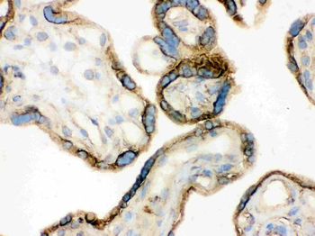 Anti-Annexin A3/ANXA3 Antibody