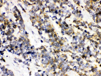 Anti-Ataxin 3/ATXN3 Antibody