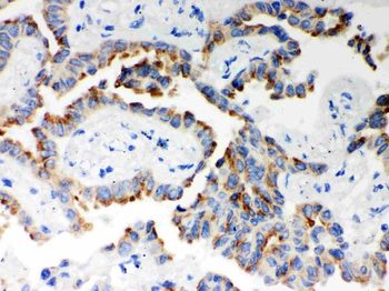 Anti-ITPR3 Antibody
