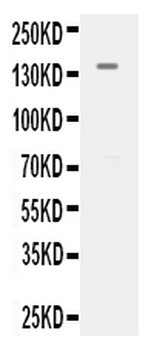 Anti-VEGF Receptor 2/KDR Antibody