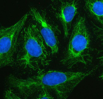 Anti-Plectin Antibody