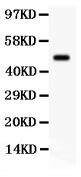 SGK1 Antibody