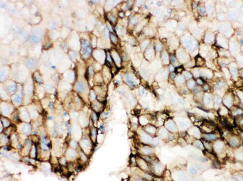 Anti-Glucose Transporter GLUT2/SLC2A2 Antibody