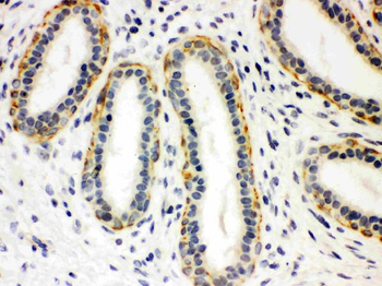 Anti-Serotonin transporter/SLC6A4 Antibody