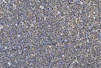 Anti-SNRPN Antibody