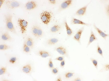 Anti-SOD2 Antibody