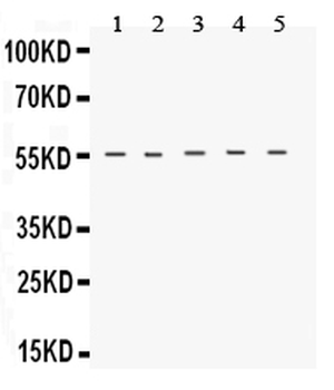 Anti-Neurokinin 1 Receptor/TACR1 Antibody