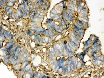 Anti-Transglutaminase 2/TGM2 Antibody
