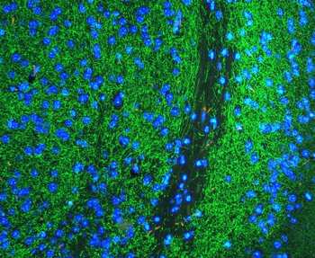 Anti-Tyrosine Hydroxylase/TH Antibody