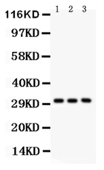 VDAC/Porin/VDAC1 Antibody