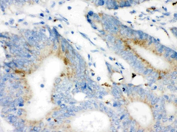 Anti-VDAC/Porin/VDAC1 Antibody