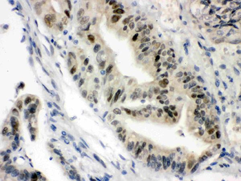 Anti-Vitamin D Receptor/VDR Antibody