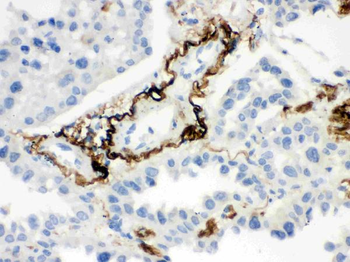 Anti-Vitronectin/VTN Antibody
