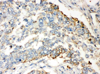 Anti-Wnt2b Antibody