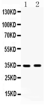 Anti-HSD17B6 Antibody