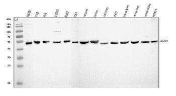 Angiotensin II Type 1 Receptor/AGTR1 Antibody