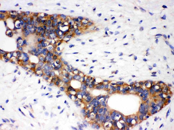 Anti-Angiotensin II Type 1 Receptor/AGTR1 Antibody